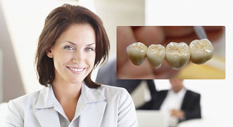 Металлокерамические коронки. Их функции и преимущества