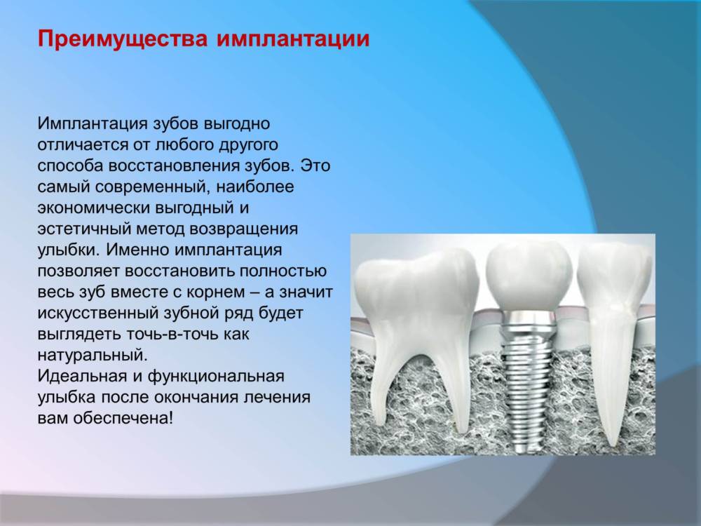 Современные технологии искусственных коронок презентация