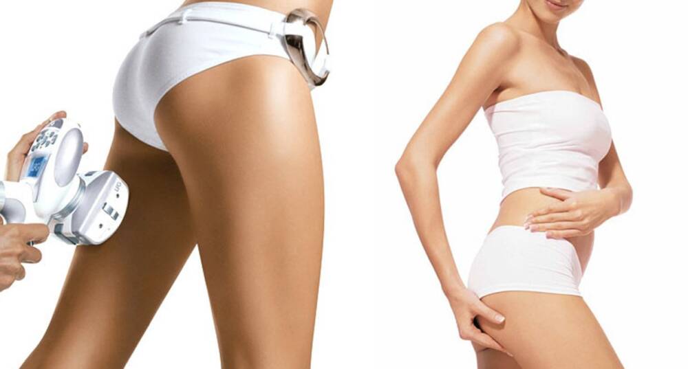 LPG-массаж как одно из самых эффективных средств в борьбе за стройность