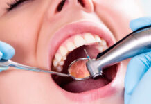 Лечение зубов при кариесе