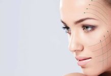 Нитевой лифтинг лица — что это?