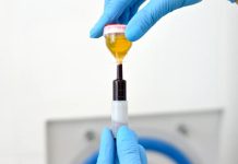 Где пройти недорого процедуры PRP-терапии: что гарантирует PRP-терапия, показания PRP-терапии, почему стоит выбирать услуги Darmed Clinic, дорого ли стоит процедура PRP-терапии