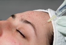 Послесолнечная реабилитация: как справиться с последствиями летних искушений