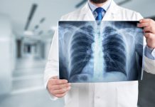 Роль флюорографии в медицине: история создания аппарата и необходимость проведения исследования