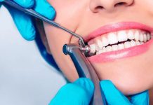 Чистка зубов в клинике: процедура, цены, плюсы