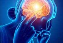 Мигрень: как справиться с головной болью и вернуть себе качество жизни